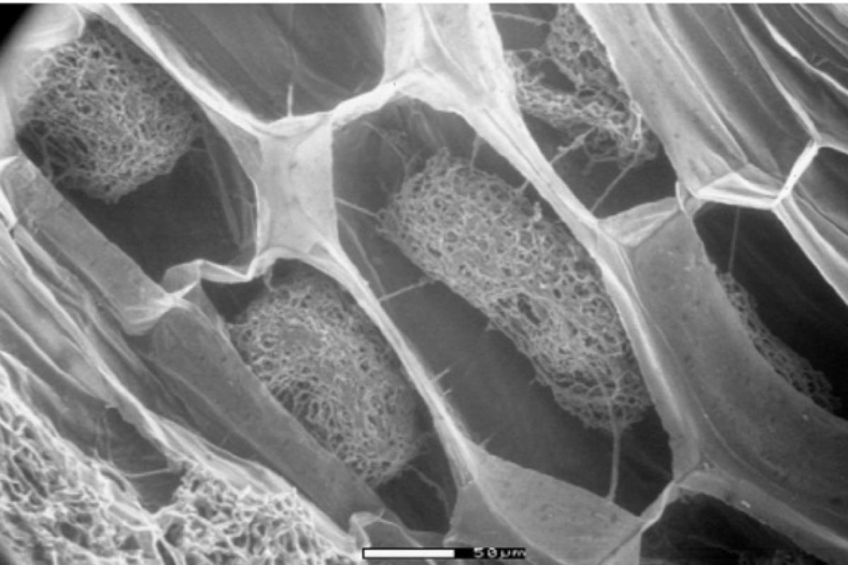 Caladenia huegelii showing bundles of fungi (pelotons) inside orchid tissue 